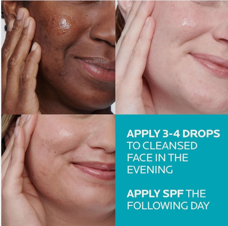 La Roche-Posay Effaclar Salicylic Acid Acne Treatment Serum – 30ml (1.0 fl. oz.) Daily Clarifying Exfoliator